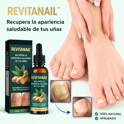 RevitaNail™ |Recupera la apariencia saludable de tus uñas ¡LLEVA 2, PAGA 1!