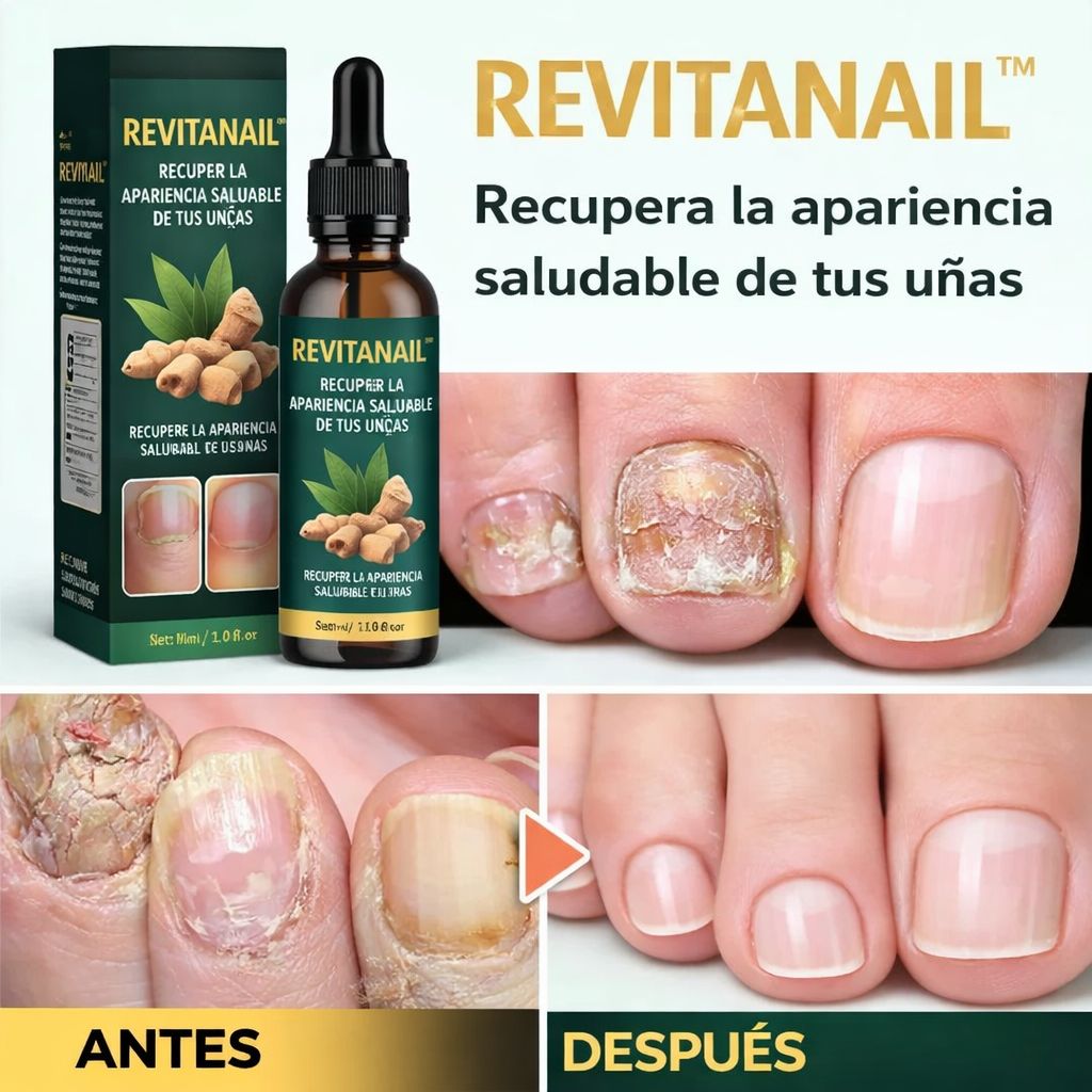 RevitaNail™ |Recupera la apariencia saludable de tus uñas ¡LLEVA 2, PAGA 1!